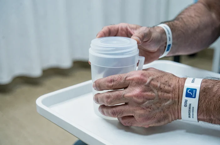 Gros plan sur un contenant médical d'analyse d'urine tenu par un patient hospitalisé